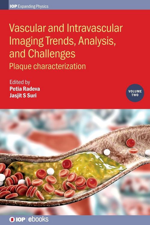 Produktbild: Vascular and Intravaslcular Imaging Trends, Analysis, and Challenges - Volume 2
