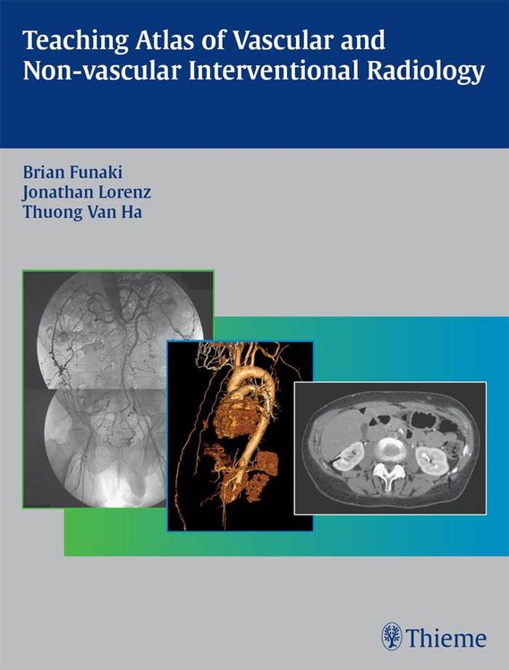 Produktbild: Teaching Atlas of Vascular and Non-vascular Interventional Radiology