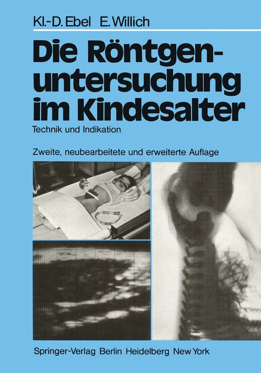 Produktbild: Die R&ouml;ntgenuntersuchung im Kindesalter