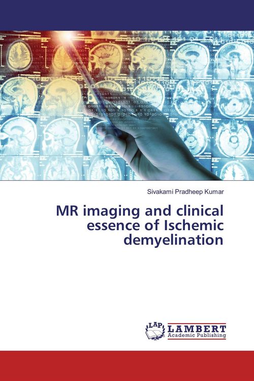 Produktbild: MR imaging and clinical essence of Ischemic demyelination
