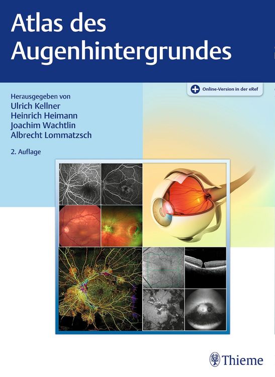 Produktbild: Atlas des Augenhintergrundes