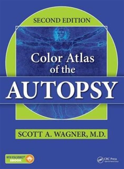 Produktbild: Wagner, S: Color Atlas of the Autopsy