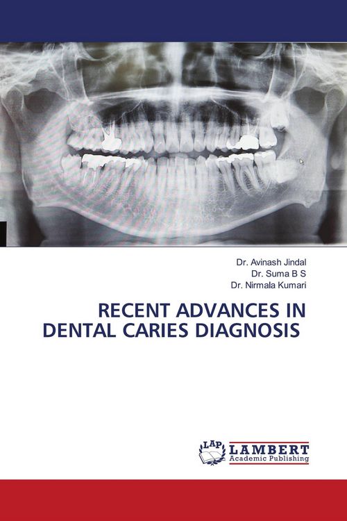 Produktbild: Recent Advances in Dental Caries Diagnosis