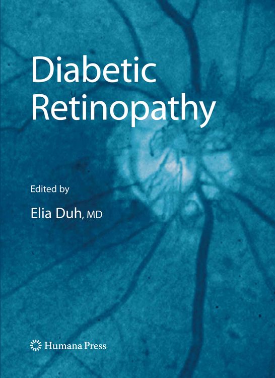 Produktbild: Diabetic Retinopathy