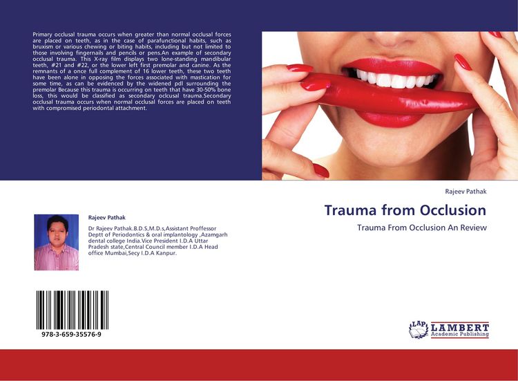 Produktbild: Trauma from Occlusion