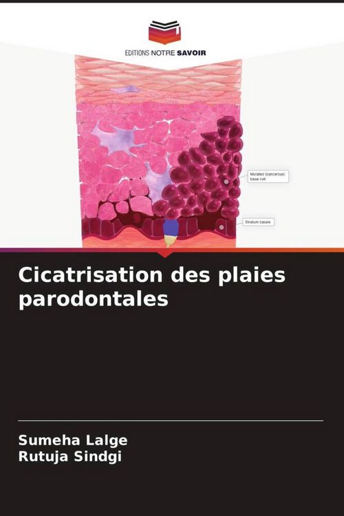 Produktbild: Cicatrisation des plaies parodontales