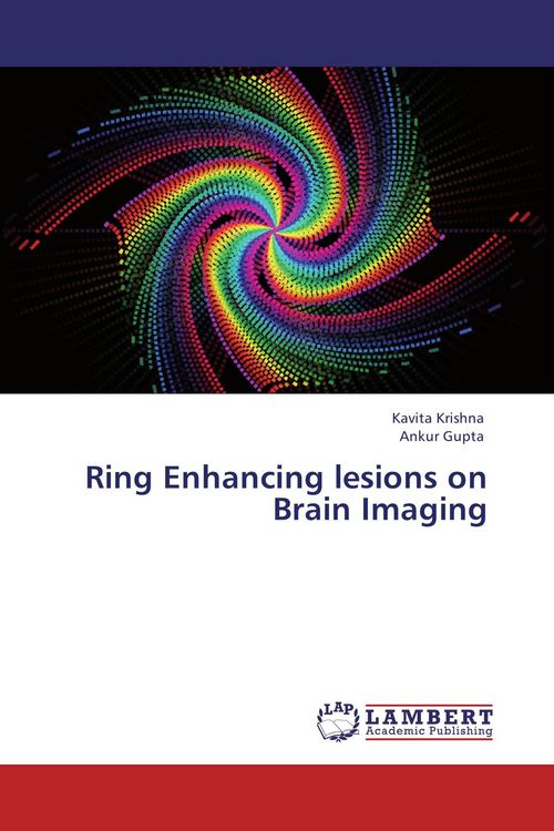 Produktbild: Ring Enhancing lesions on Brain Imaging