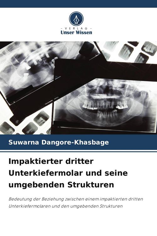 Produktbild: Impaktierter dritter Unterkiefermolar und seine umgebenden Strukturen