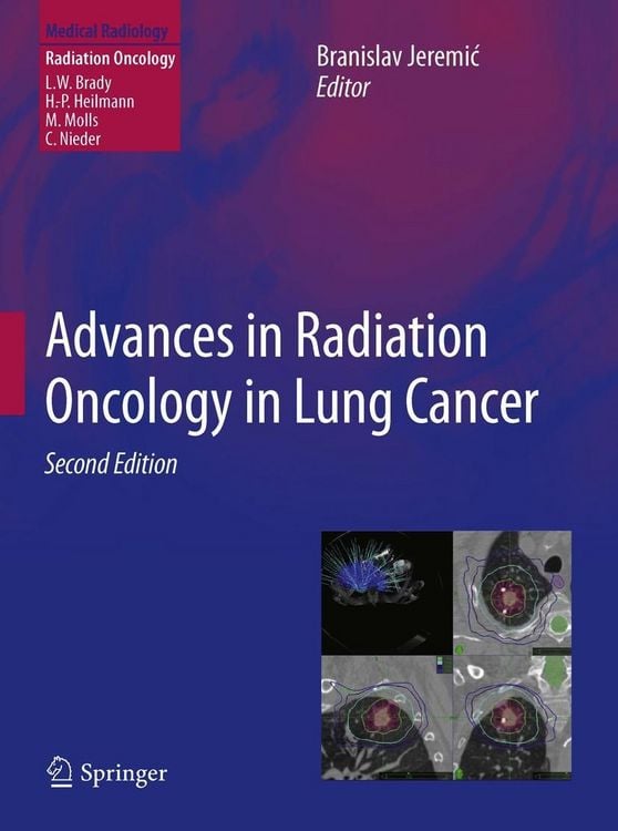 Produktbild: Advances in Radiation Oncology in Lung Cancer