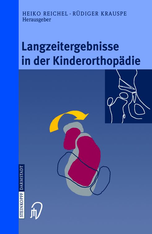 Produktbild: Langzeitergebnisse in der Kinderorthop&auml;die