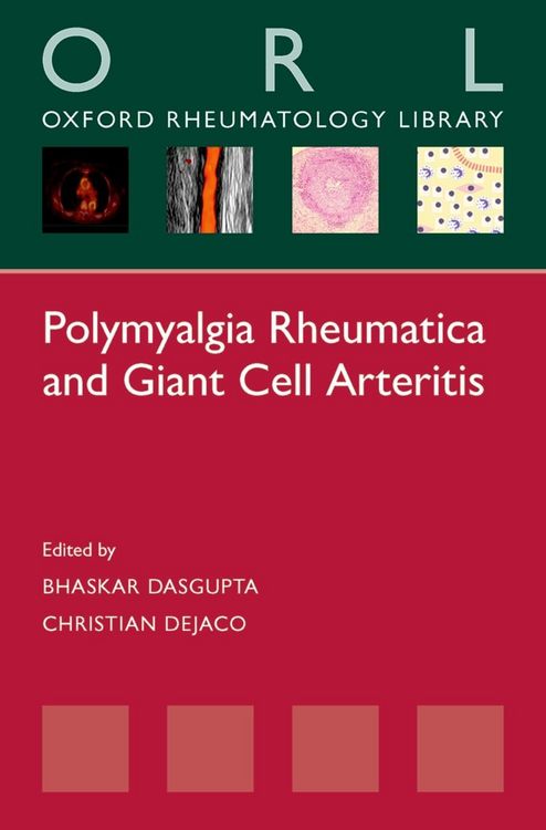 Produktbild: Polymyalgia Rheumatica and Giant Cell Arteritis