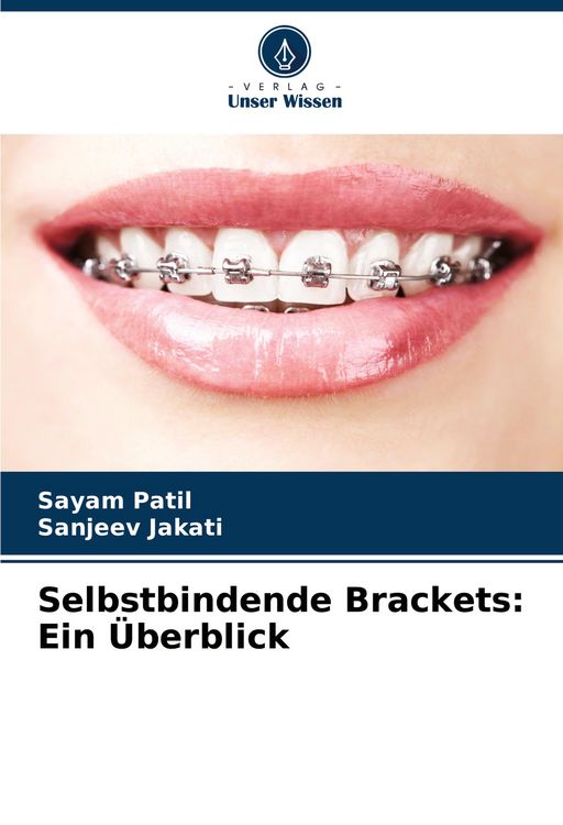 Produktbild: Selbstbindende Brackets: Ein &Uuml;berblick