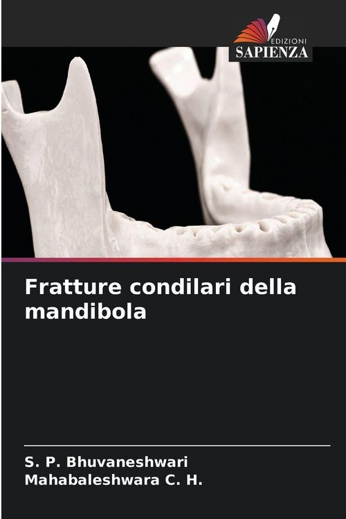 Produktbild: Fratture condilari della mandibola