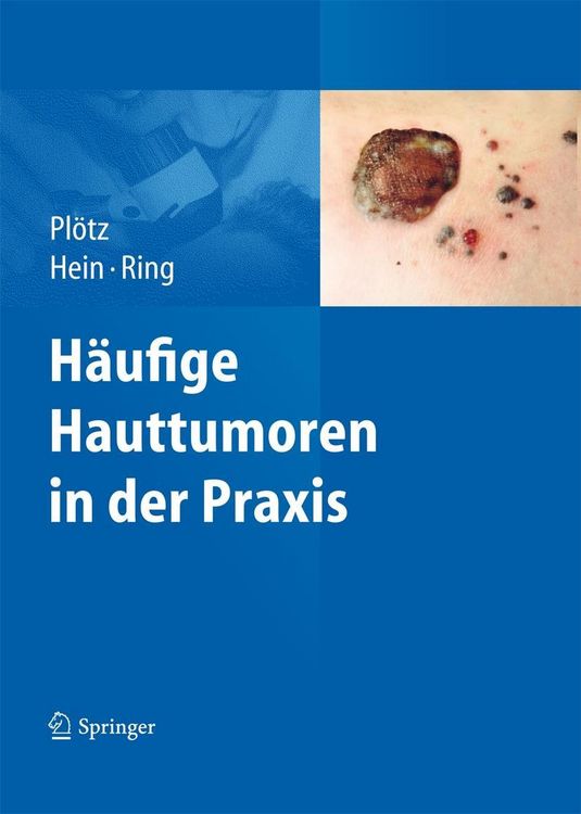 Produktbild: H&auml;ufige Hauttumoren in der Praxis
