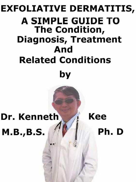 Produktbild: Exfoliative Dermatitis, (Erythroderma) A Simple Guide To The Condition, Diagnosis, Treatment And Related Conditions