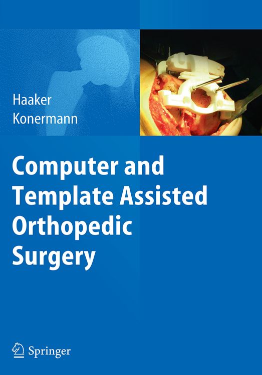 Produktbild: Computer and Template Assisted Orthopedic Surgery