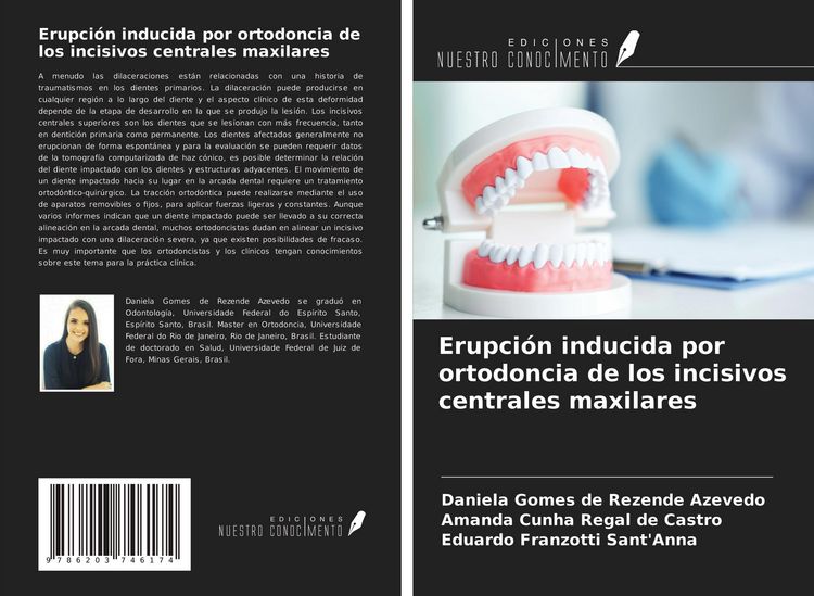 Produktbild: Erupci&oacute;n inducida por ortodoncia de los incisivos centrales maxilares