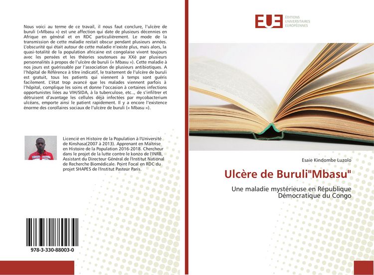 Produktbild: Ulc&egrave;re de Buruli"Mbasu"