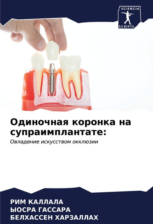 Produktbild: Odinochnaq koronka na supraimplantate: