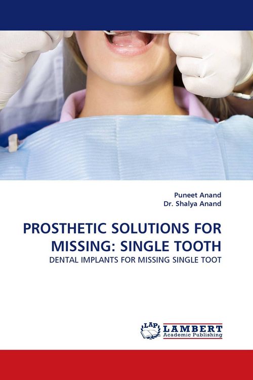 Produktbild: Prosthetic Solutions For Missing: Single Tooth