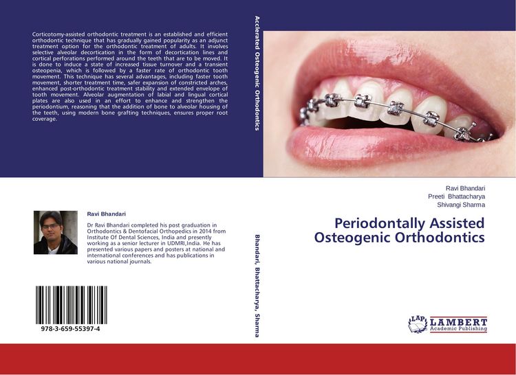 Produktbild: Periodontally Assisted Osteogenic Orthodontics