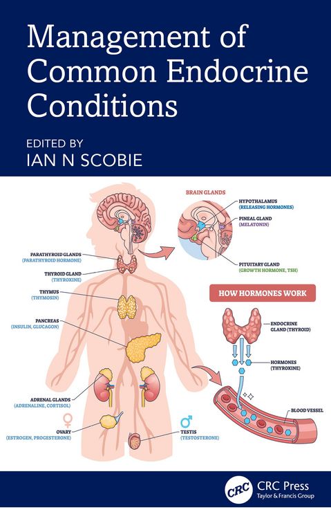 Produktbild: Management of Common Endocrine Conditions