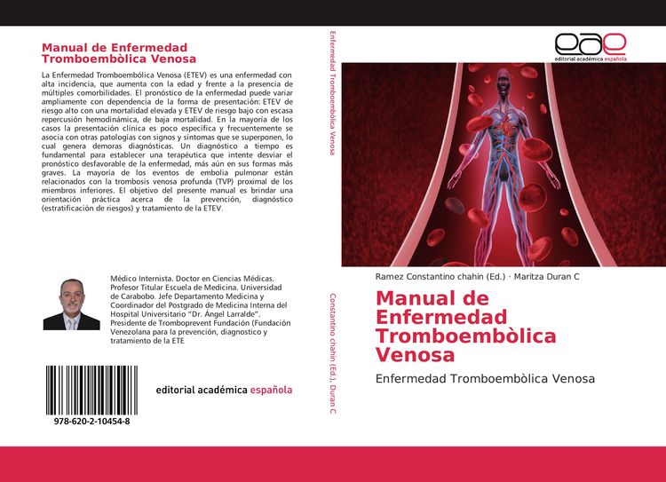 Produktbild: Manual de Enfermedad Tromboemb&ograve;lica Venosa
