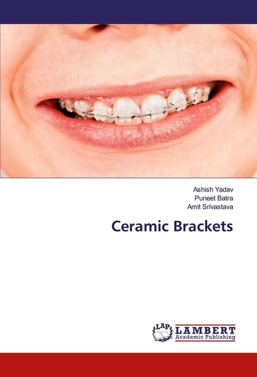 Produktbild: Ceramic Brackets