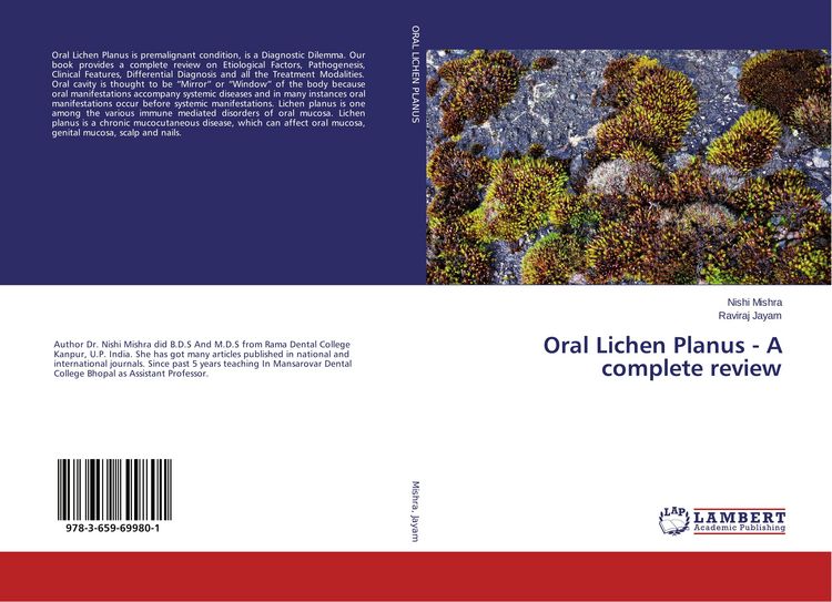 Produktbild: Oral Lichen Planus - A complete review