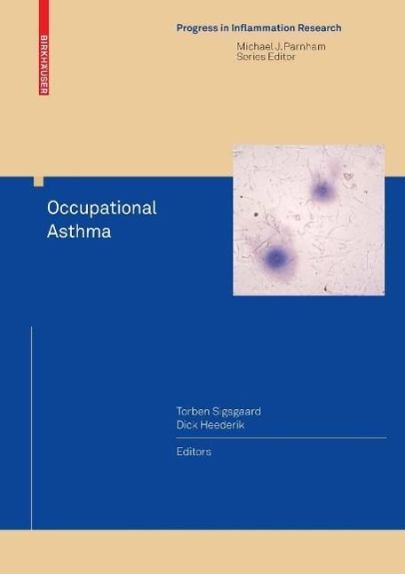 Produktbild: Occupational Asthma