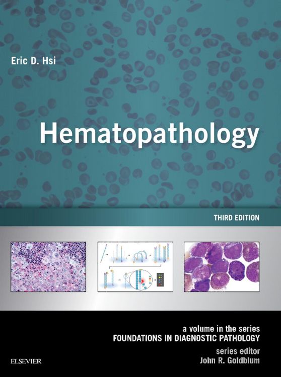 Produktbild: Hematopathology E-Book