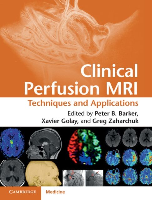 Produktbild: Clinical Perfusion MRI