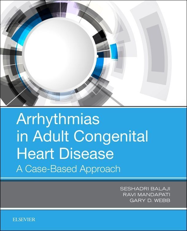 Produktbild: Arrhythmias in Adult Congenital Heart Disease