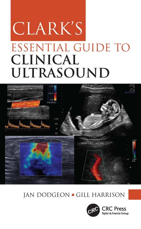 Produktbild: Clark's Essential Guide to Clinical Ultrasound