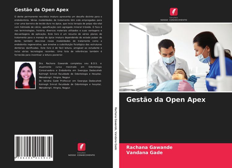 Produktbild: Gest&atilde;o da Open Apex