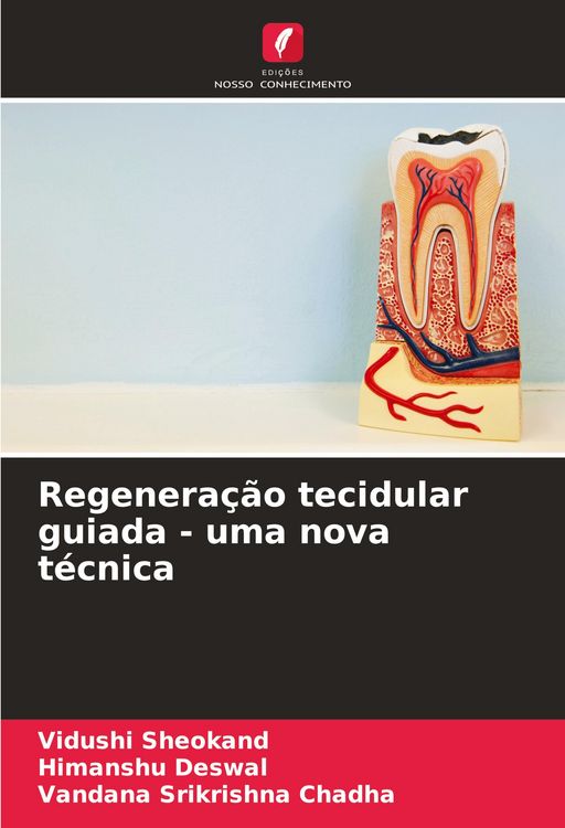 Produktbild: Regenera&ccedil;&atilde;o tecidular guiada - uma nova t&eacute;cnica