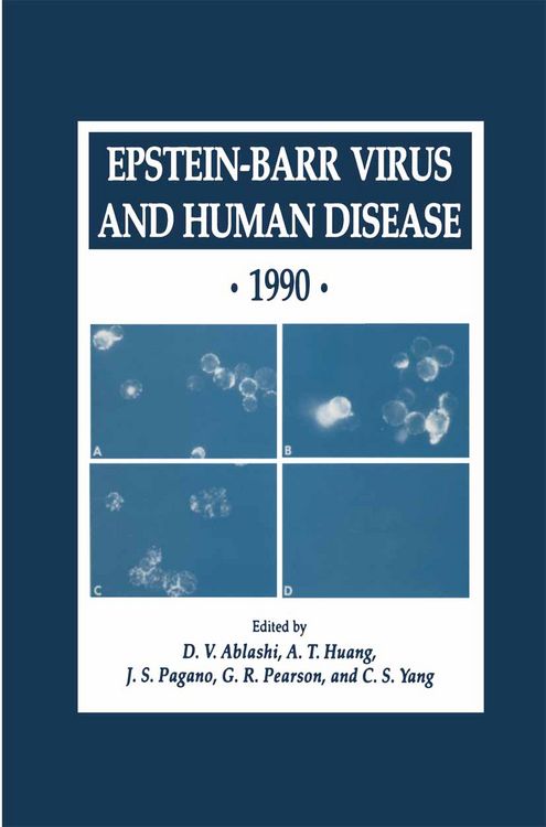 Produktbild: Epstein-Barr Virus and Human Disease &middot; 1990