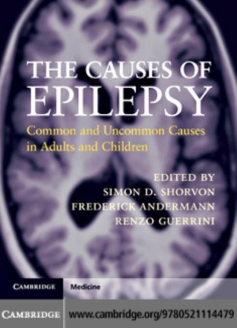 Produktbild: Causes of Epilepsy