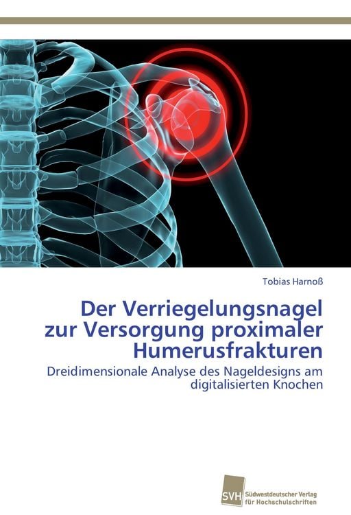 Produktbild: Der Verriegelungsnagel zur Versorgung proximaler Humerusfrakturen