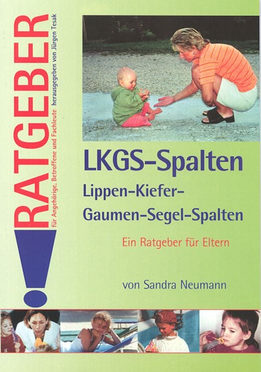 Produktbild: Lippen-Kiefer-Gaumen-Segel-Spalten (LKGS)