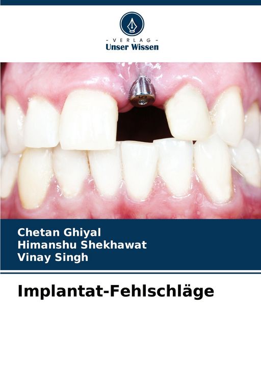 Produktbild: Implantat-Fehlschl&auml;ge