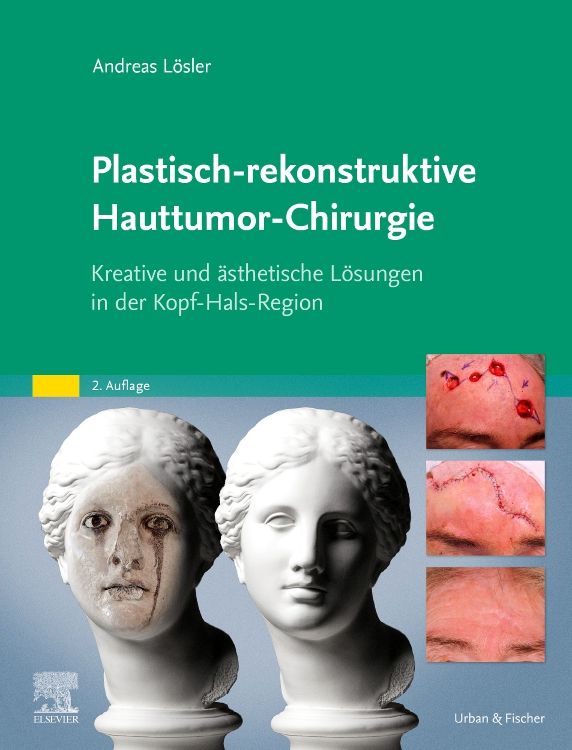 Produktbild: Plastisch-rekonstruktive Hauttumor-Chirurgie