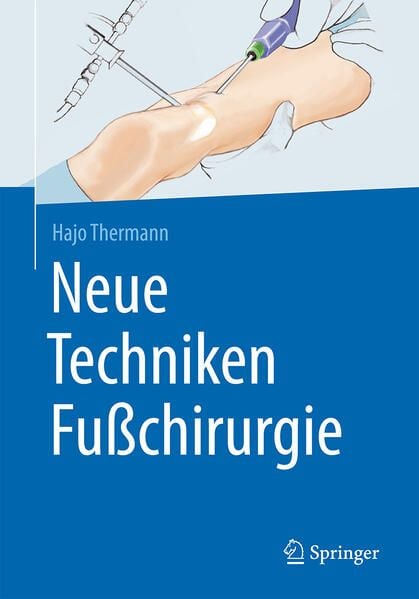 Produktbild: Neue Techniken Fu&szlig;chirurgie