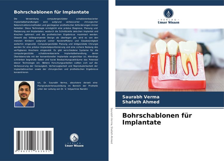 Produktbild: Bohrschablonen f&uuml;r Implantate