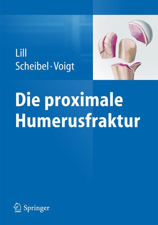 Produktbild: Die proximale Humerusfraktur