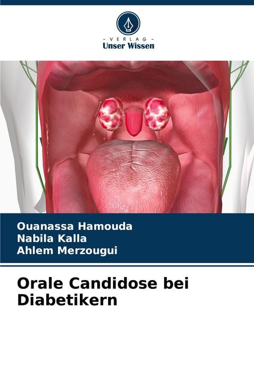 Produktbild: Orale Candidose bei Diabetikern