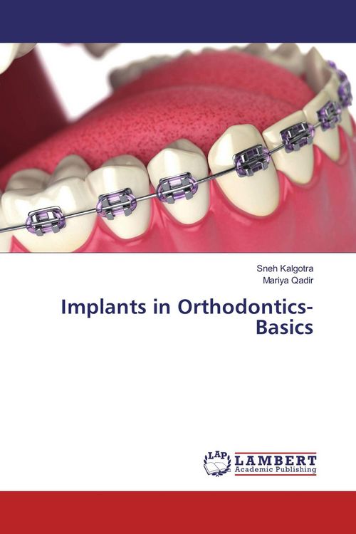 Produktbild: Implants in Orthodontics- Basics