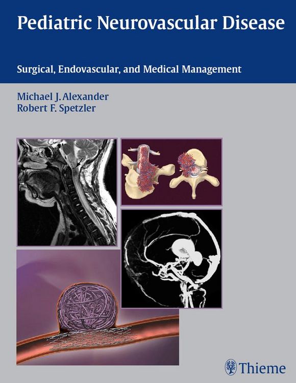 Produktbild: Pediatric Neurovascular Disease