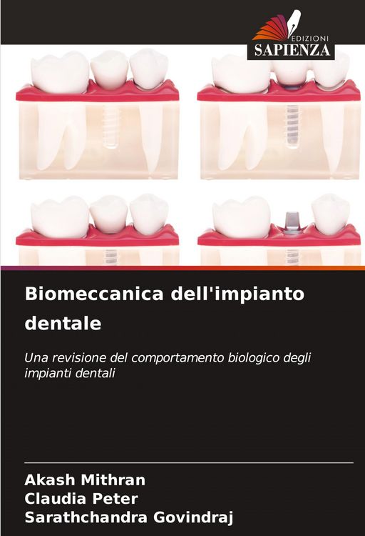 Produktbild: Biomeccanica dell'impianto dentale