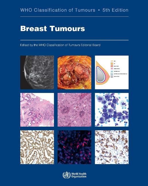 Produktbild: Breast Tumours
